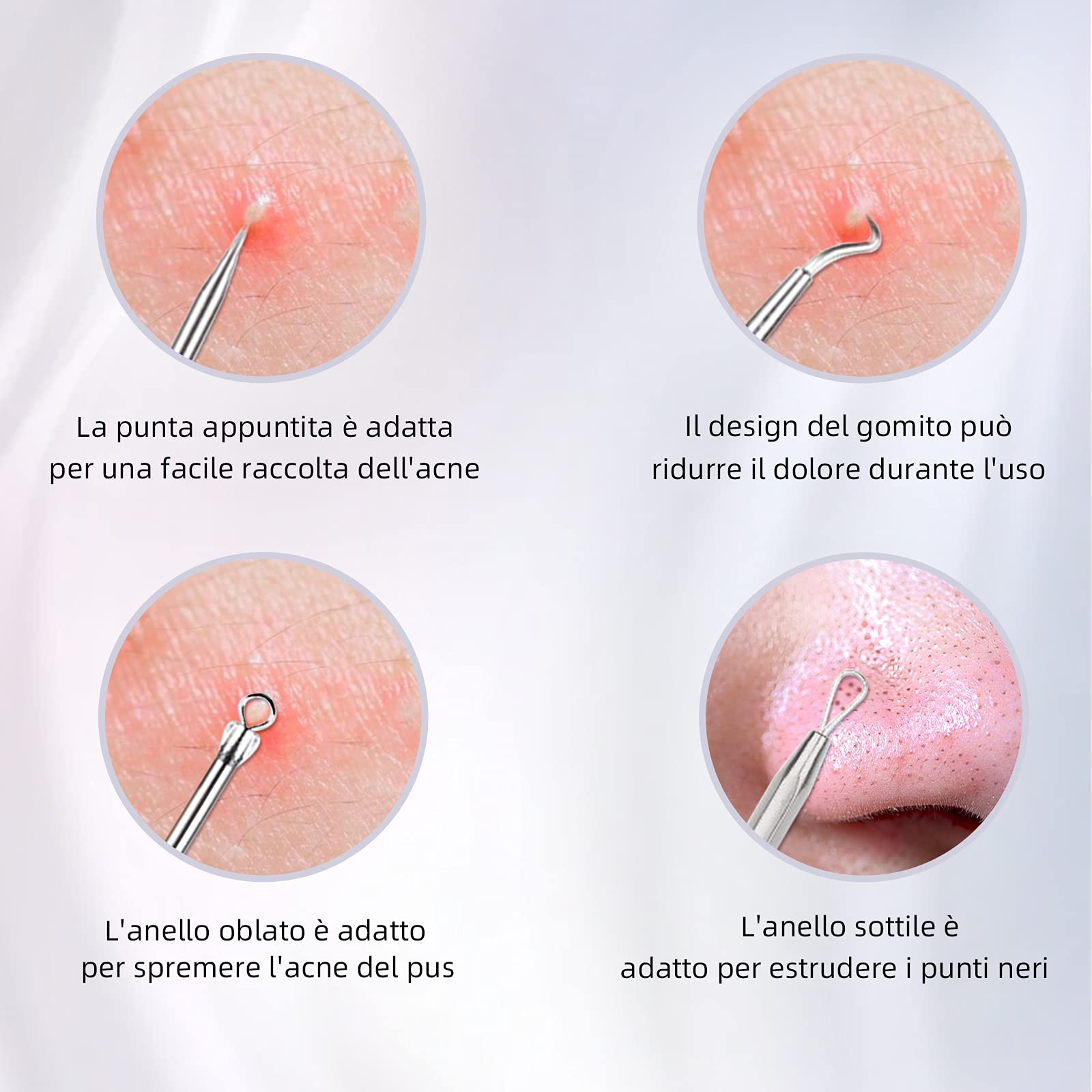 Kit di Strumenti Rimozione Punti Neri 5 Pezzi, Blackhead Estrattore Ago Acne in Acciaio Inossidabile con Scatola, per il Trattamento e la Togli di Comedoni sul Naso o Viso