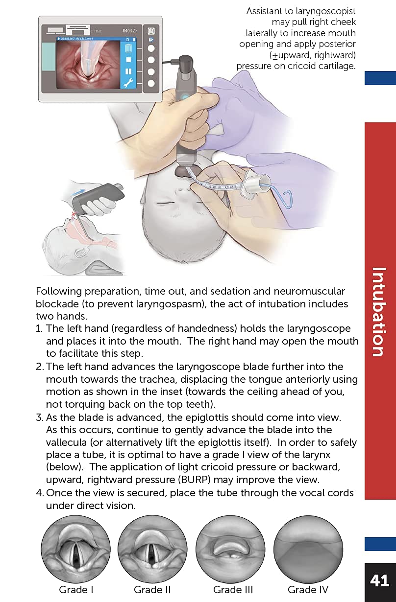 Boston Children's Hospital Cardiac ICU Manual For Bedside Providers - an illustrated handbook of congenital heart disease      Spiral-bound – January 1, 2021