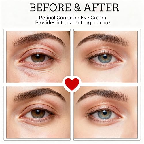 Miniatura 6 de Crema de ojos de retinol con niacinamida, ácido hialurónico y vitamina E Crema hidratante debajo de los ojos para ojeras visibles, apariencia de