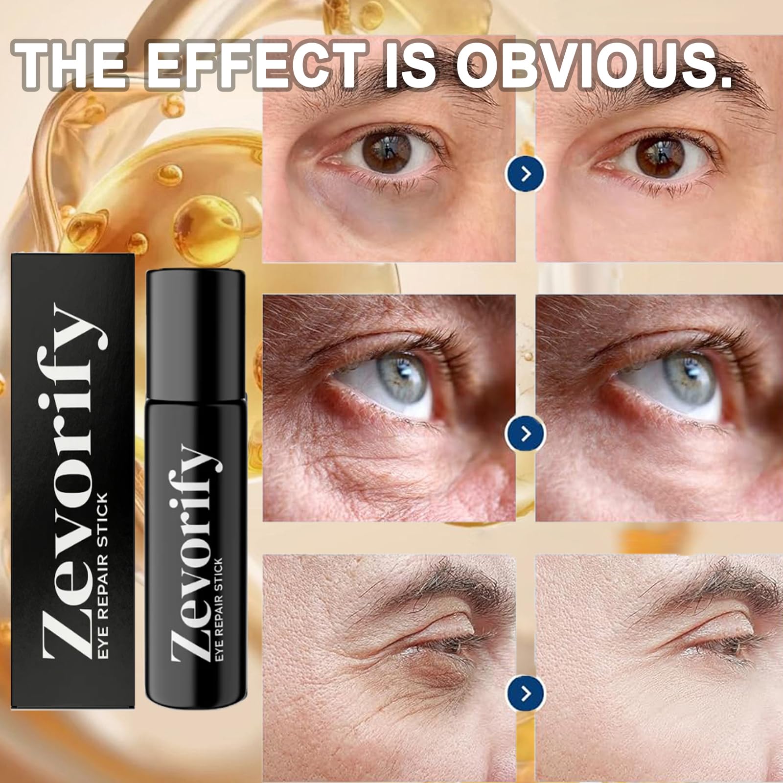 Amazon.com: Zevorify Eye Repair Stick for Men, Under Eye Roller