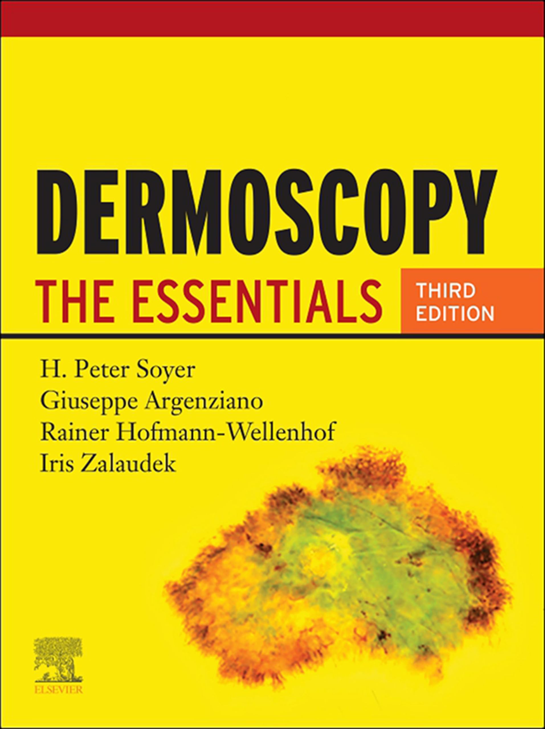 Dermoscopy E-Book: The Essentials (English Edition)
