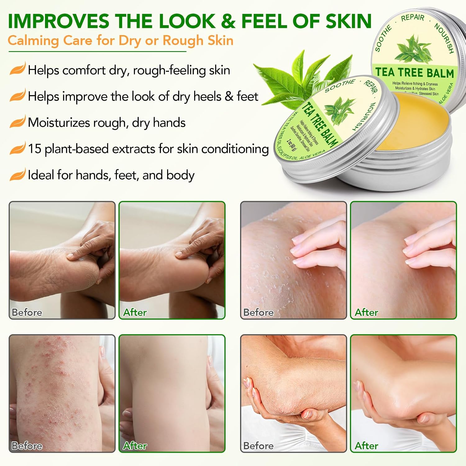 ABOUME Tea Tree Oil Balm, Tea Tree Balm Help Dry, Itchy & Fungal-Prone Skin, Soothing Moisturizing Balm Suitable for Feet, Heels, Hands & Body, Natural Formula, 60g (1PCS)