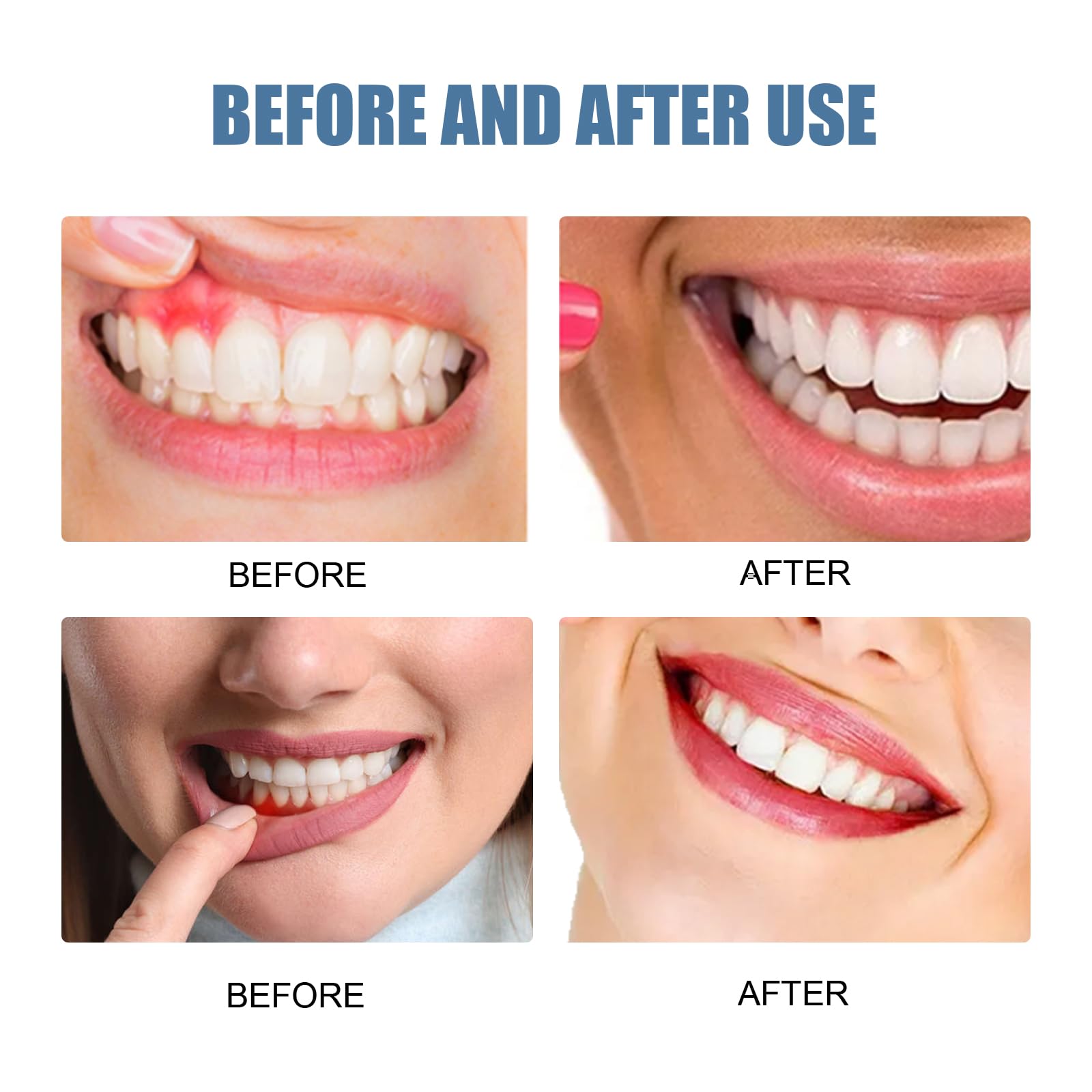 Trattamento riparatore per gengive retratte, spray antidolorifico dentale, spray orale alla propoli, sollievo dal mal di denti, lenimento rapido delle gengive, attenuazione (8 pezzi)