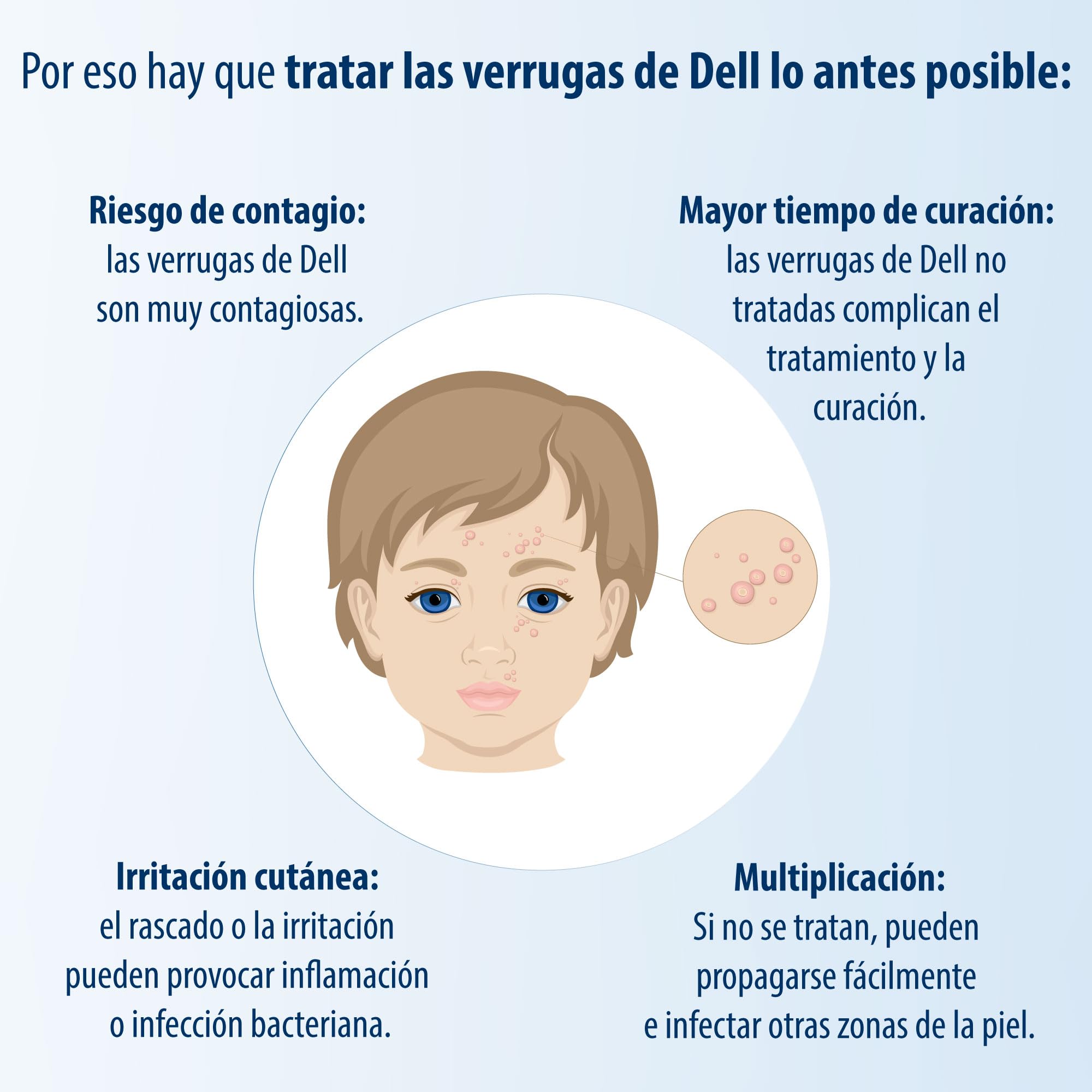 Evolsin® Remedio para el molusco contagioso I Para adultos y niños a partir de 2 años I Tratamiento suave y eficaz del molusco contagioso