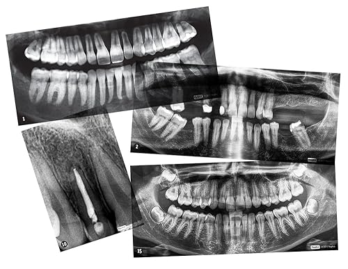 Radiografías dentales