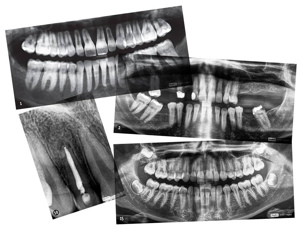Amazon.co.jp: Dental X-Rays : 産業・研究開発用品