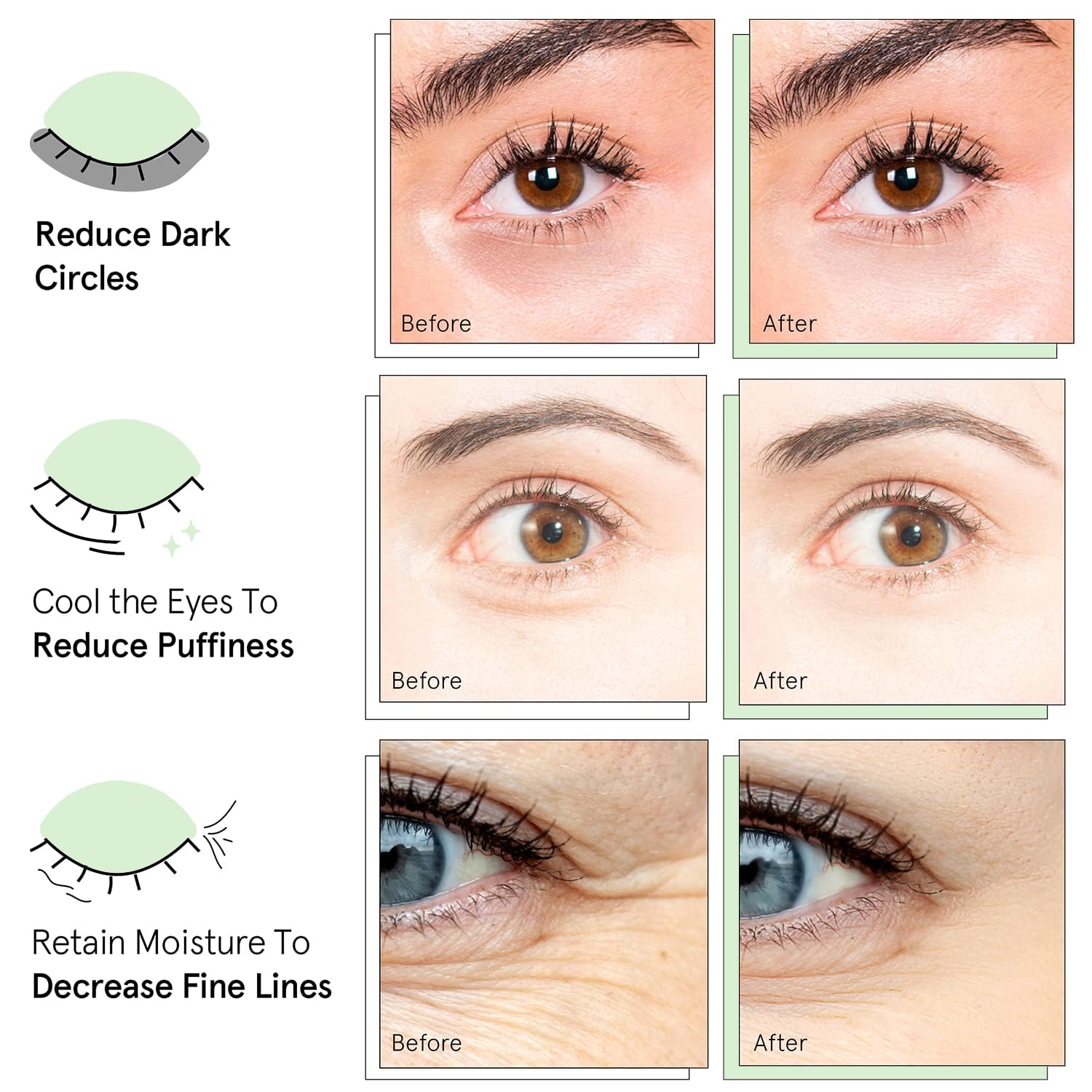 QUIA Beauty Parche de hidrogel Chia Eye con colágeno – Desinflame, suaviza las líneas de expresión e hidrata en 15 minutos, fórmula antideslizante y calmante – 20 pares para todo tipo de piel