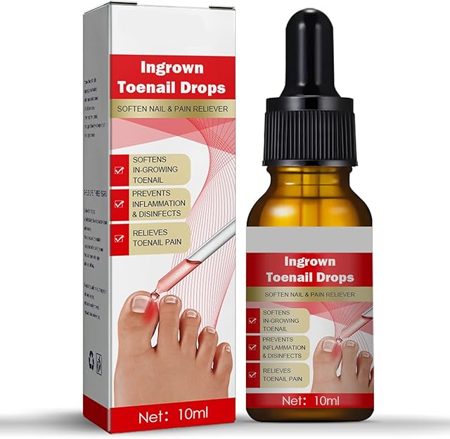 Ingrown Toenail Treatment - Ingrown Toenail - Cuticle Care Oils for Ingrown Toenails - Trimming Toenail Softening Drops Natural Ingrown Toenail Correction Treatment Fungal Nail Treatment - 10ml (1Pcs)
