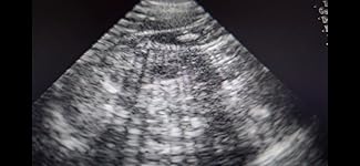 Review Image by Dawn Dawn