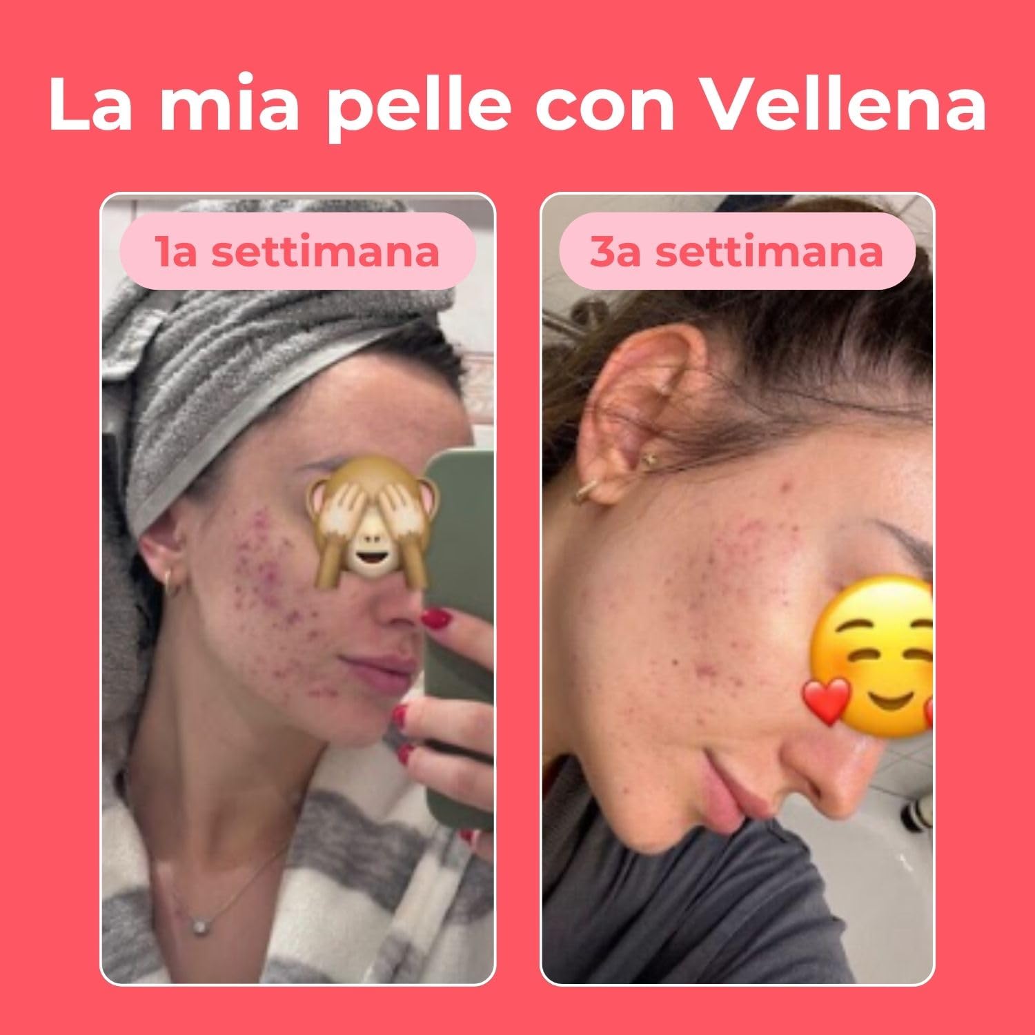 Bevanda per la salute femminile - Che allevia SPM, Acne, Mestruazioni Irregolari e Dolorose, Crampi e Gonfiori, Perdita di capelli, Menopausa problematica (3PACK, Amarena)