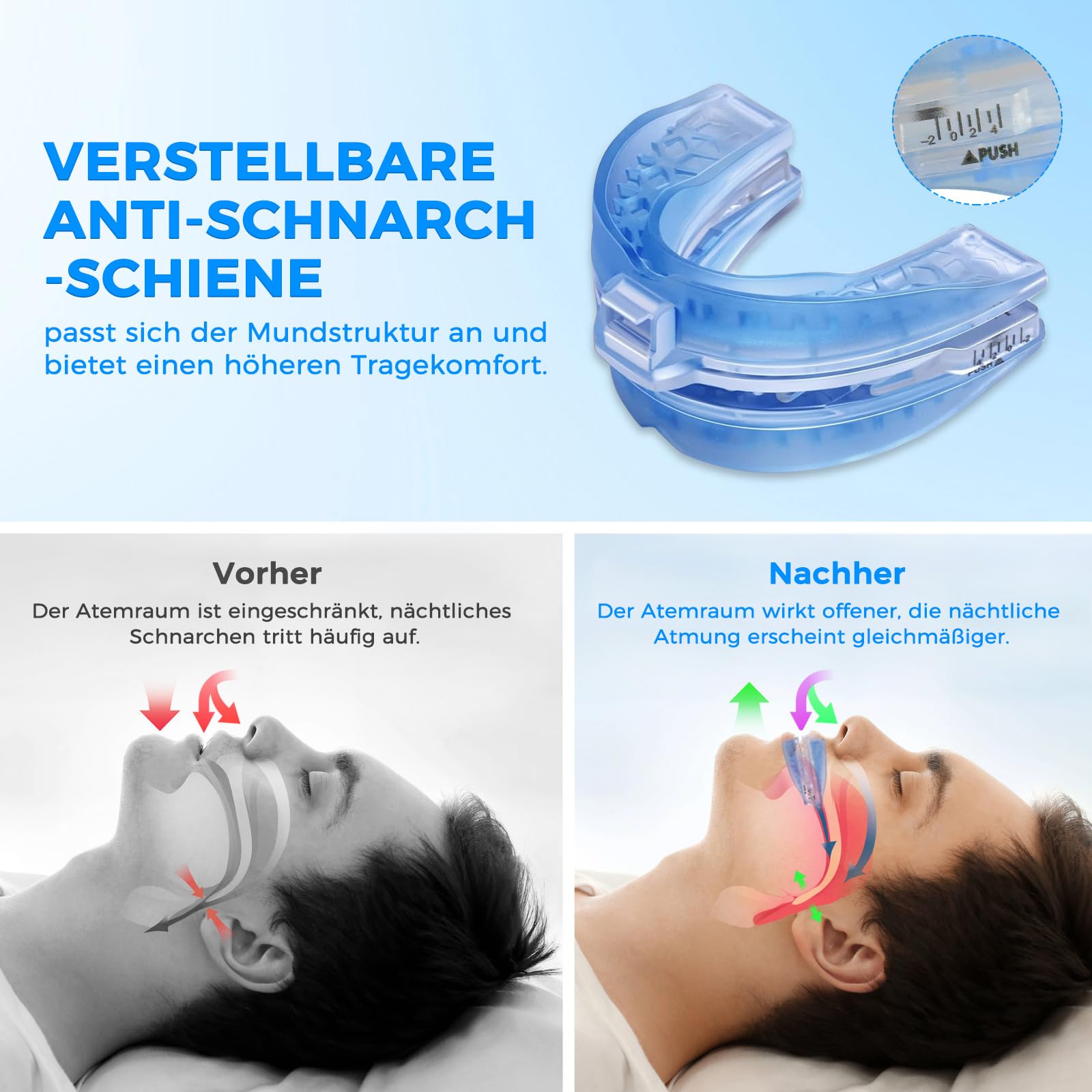 Schnarchschiene Anti Schnarch, Gegen Schnarchen und Knirschen | Professionelle Schnarchstopper, Verstellbare Aufbissschiene, Schnarchen Stopper, Verbesserte Schlafqualtät
