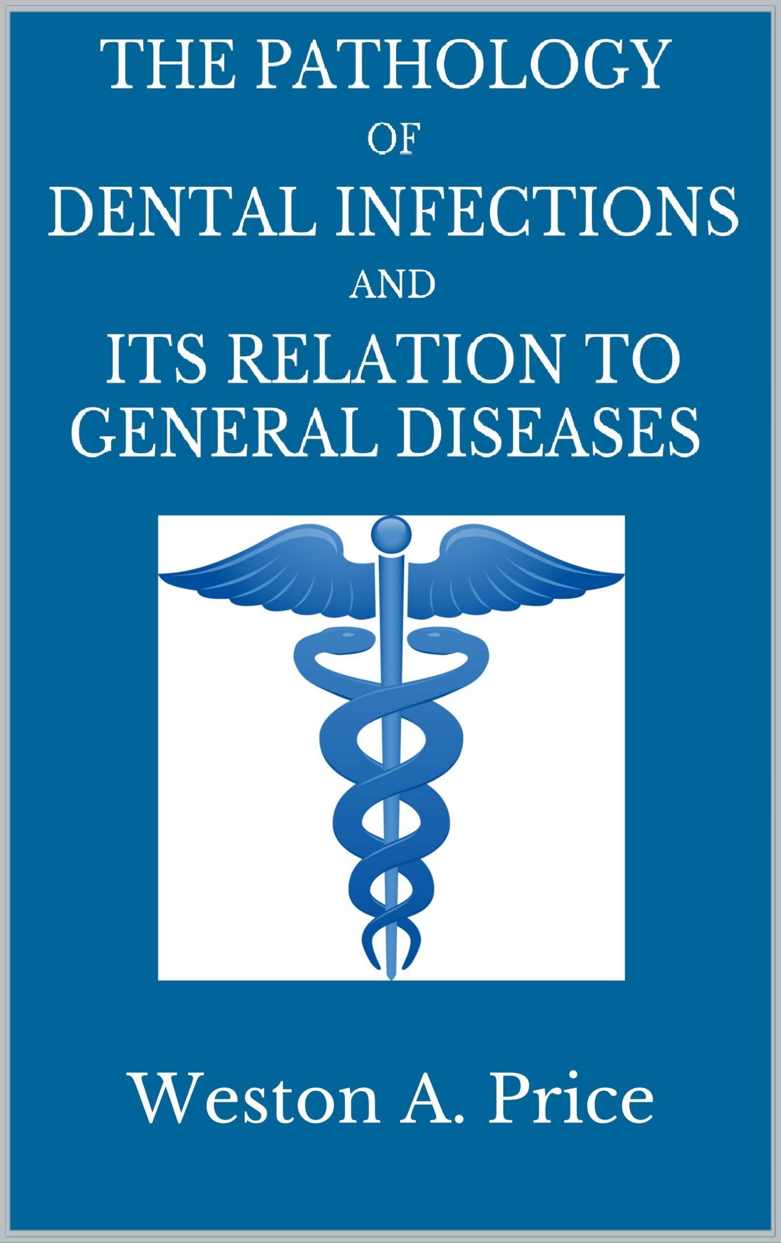 The Pathology of Dental Infections: and Its Relation to General Diseases - History of Dentistry