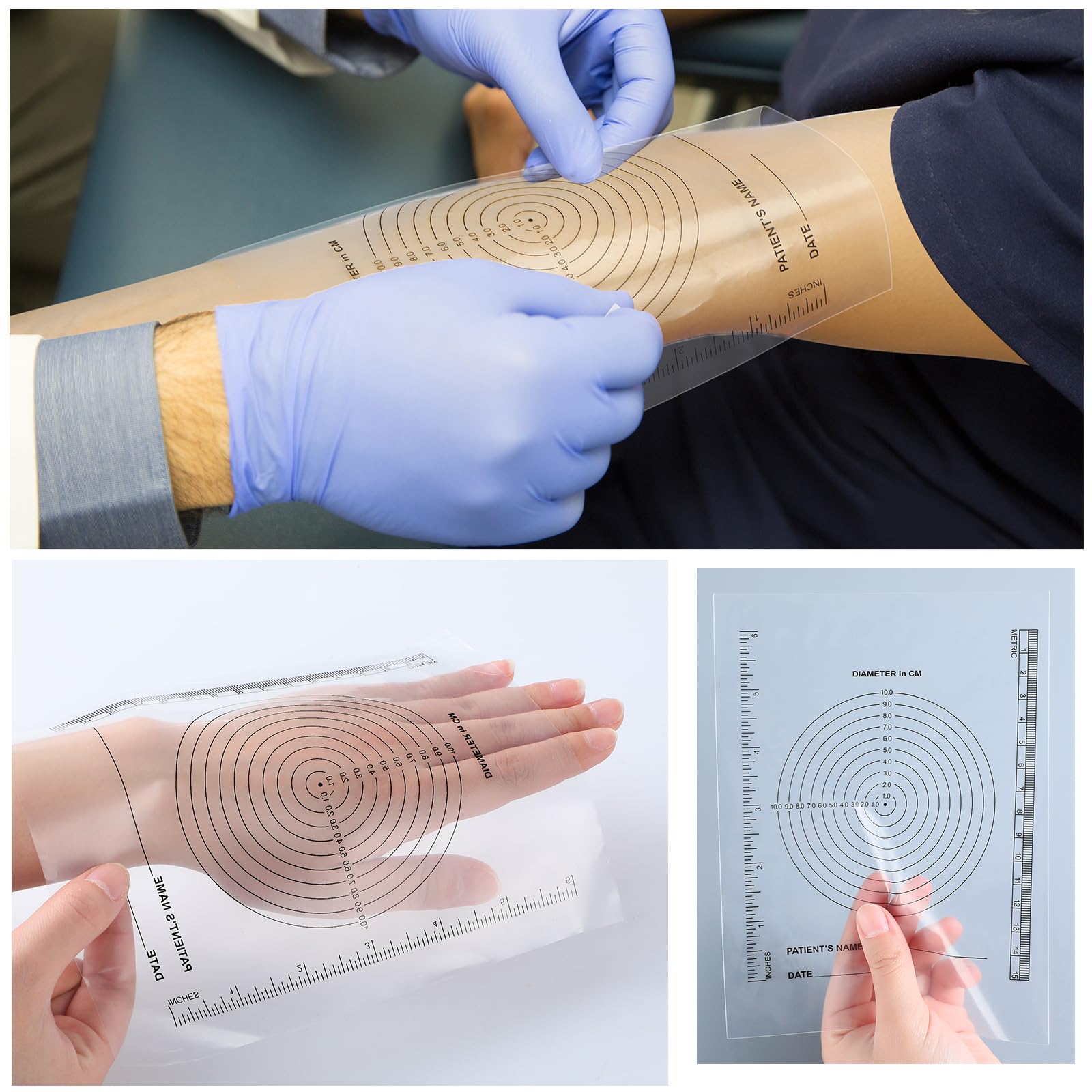 Motiskyy Paquete de 300 herramientas de medición de heridas, guía de diana, regla médica, guía de medición de heridas suave y flexible para enfermeras y pacientes