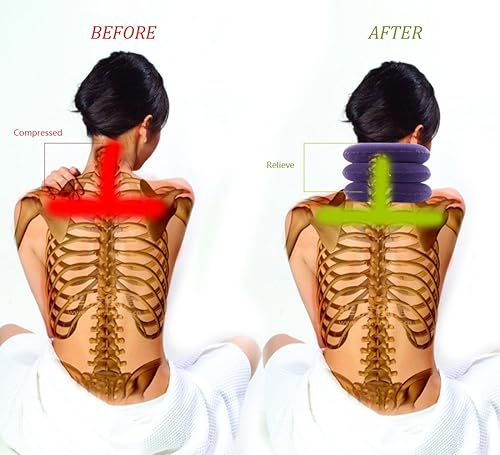 Miniatura 3 de Dispositivo de tracción cervical para cuello hinchable fácil de usar para alivio de dolor crónico de cuello y hombro alineación de tracción cuello