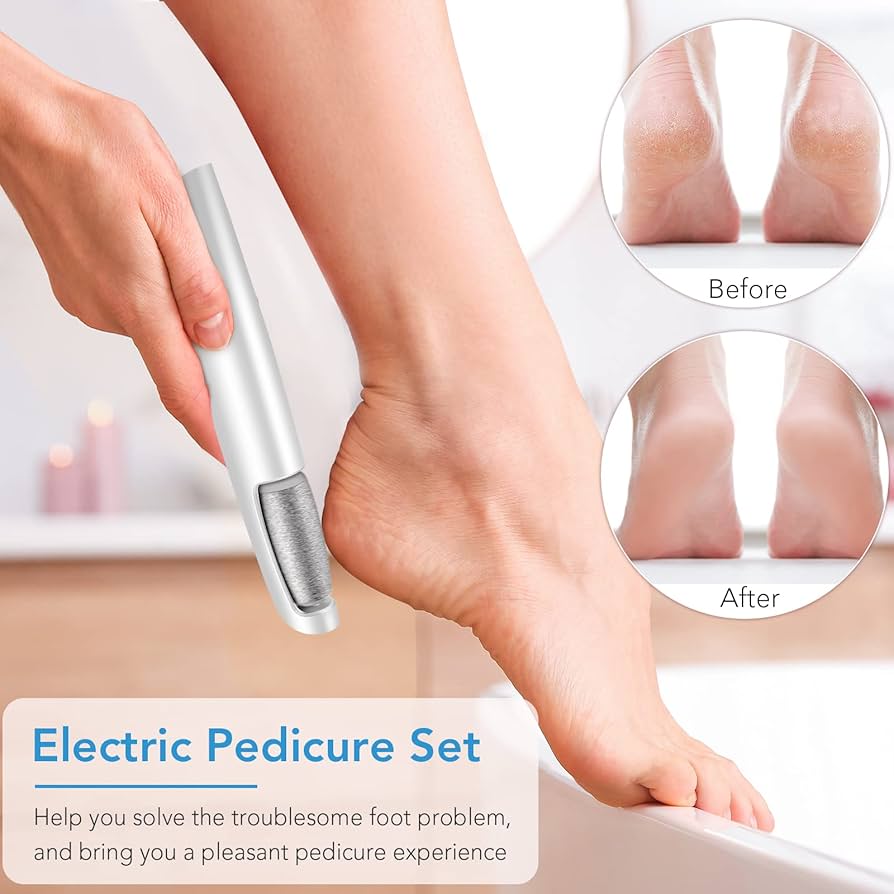 フットケア Electric Callus Remover フットケア Electric Callus Remover Electric Foot Callus