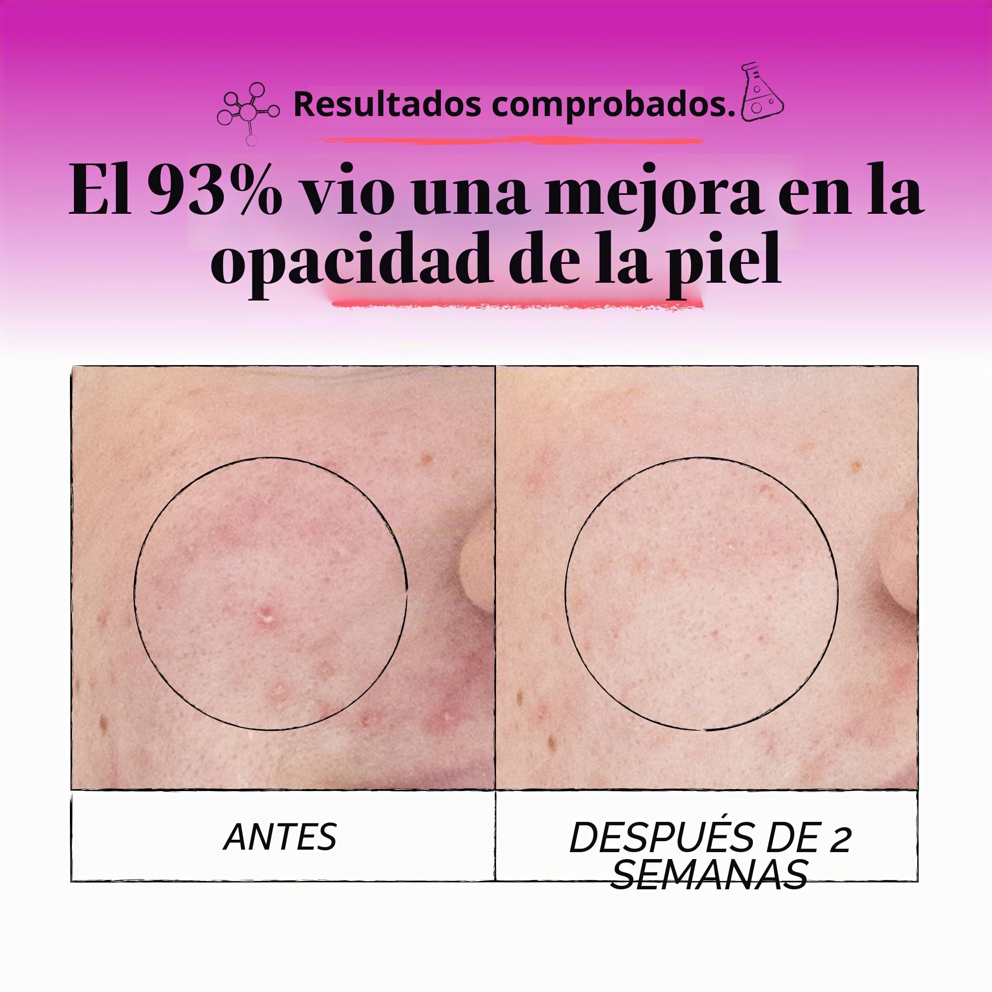 Derma E - Exfoliante de microdermoabrasión (56 g)