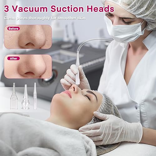 Miniatura 10 de Yofuly - Máquina de microdermoabrasión de diamante, máquina de microdermoabrasión profesional 3 en 1 con tubo de vidrio al vacío y botella rociadora