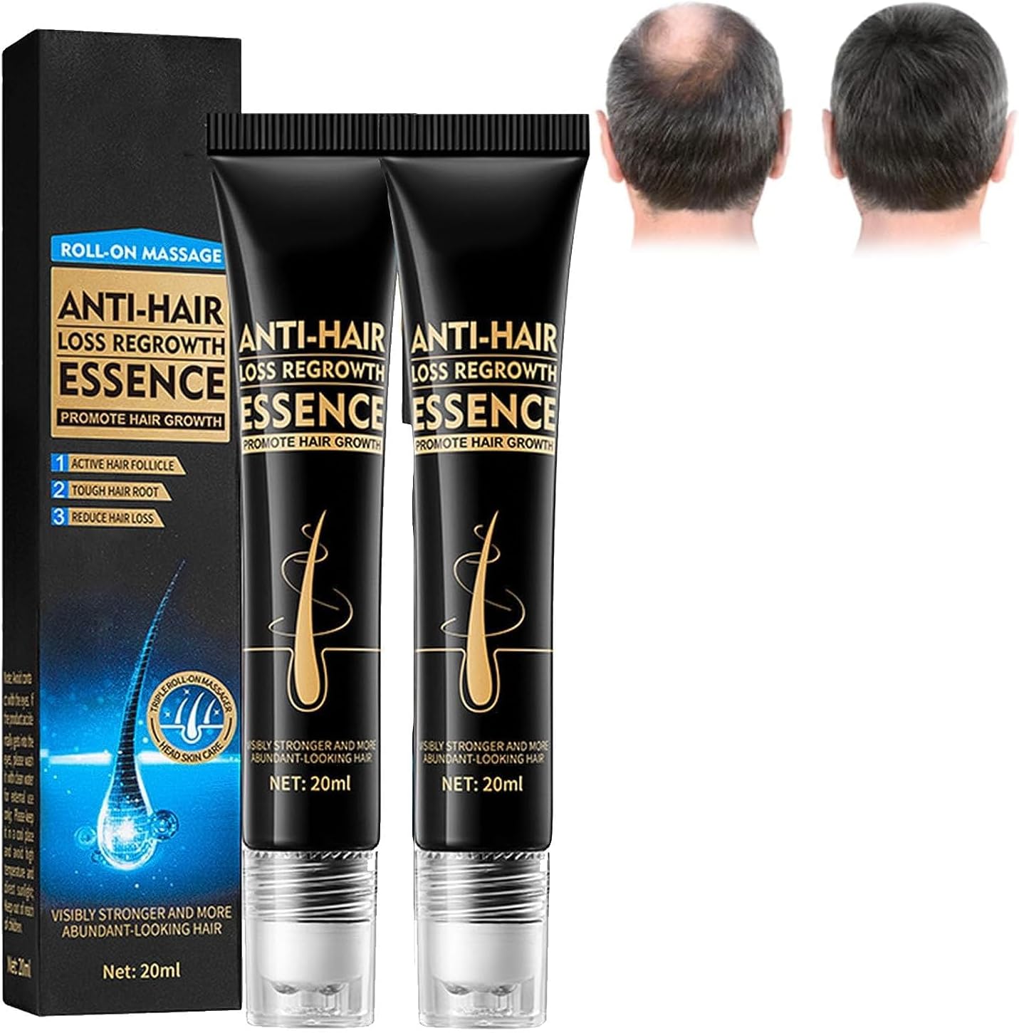 Biotin Roll-On Essence, Anti-Hair Loss Keratin Serum for Frizzy & Damaged Hair (2PCS)