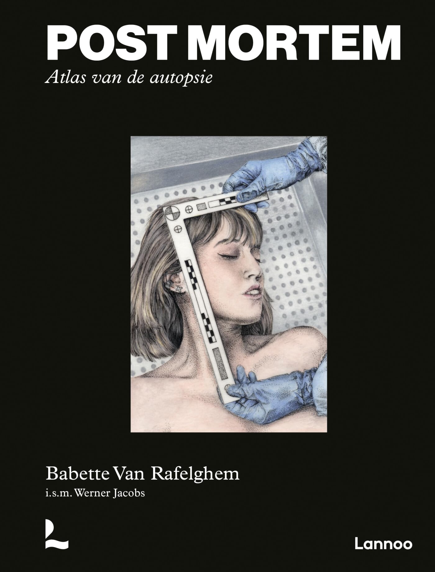 Post mortem: atlas van de autopsie
