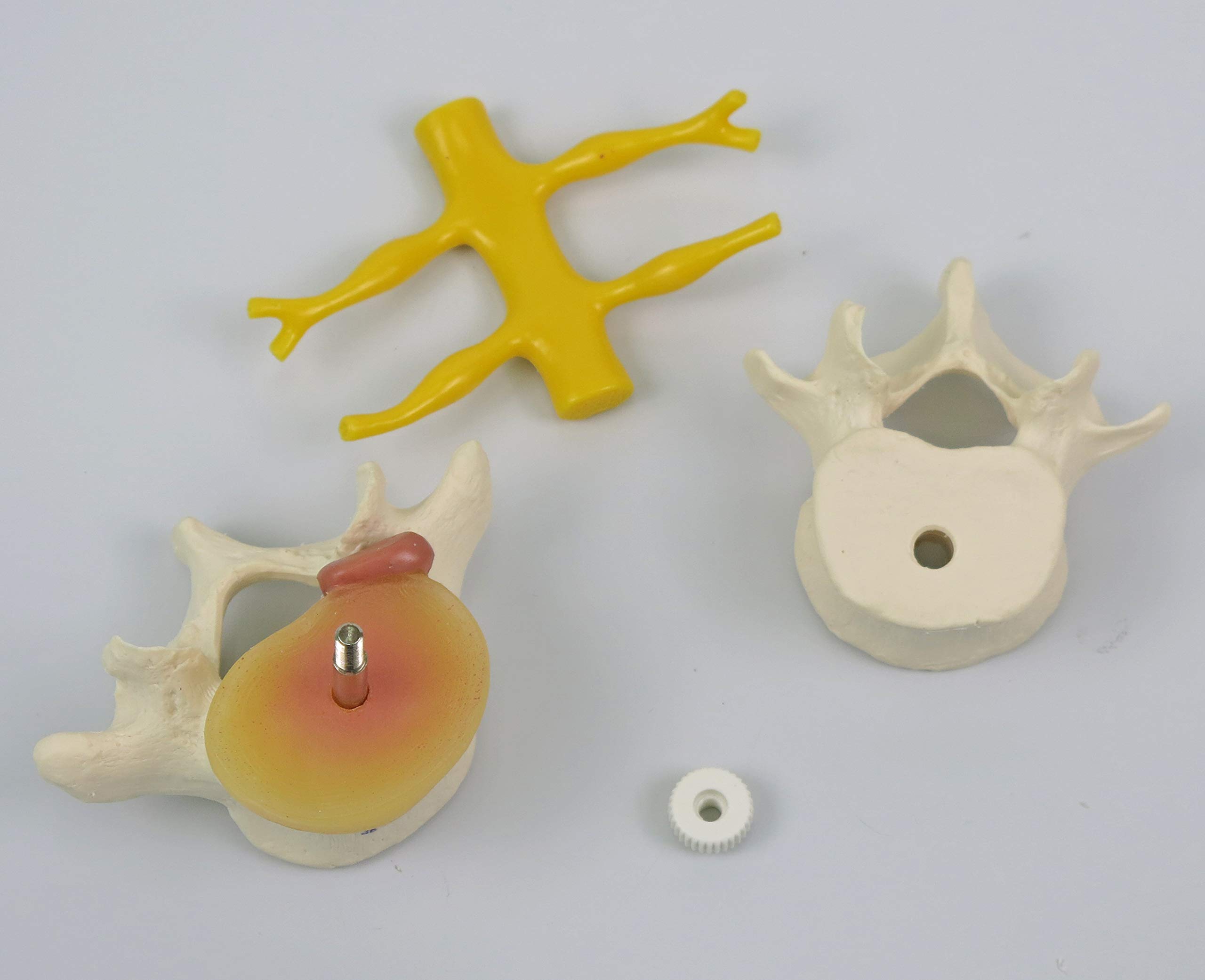 3B Scientific® 2 Vertèbres Lombaires avec Hernie Discale – Modèles Anatomiques Montés de Manière Flexible + Smart Anatomy App (Garantie de 5 Ans)