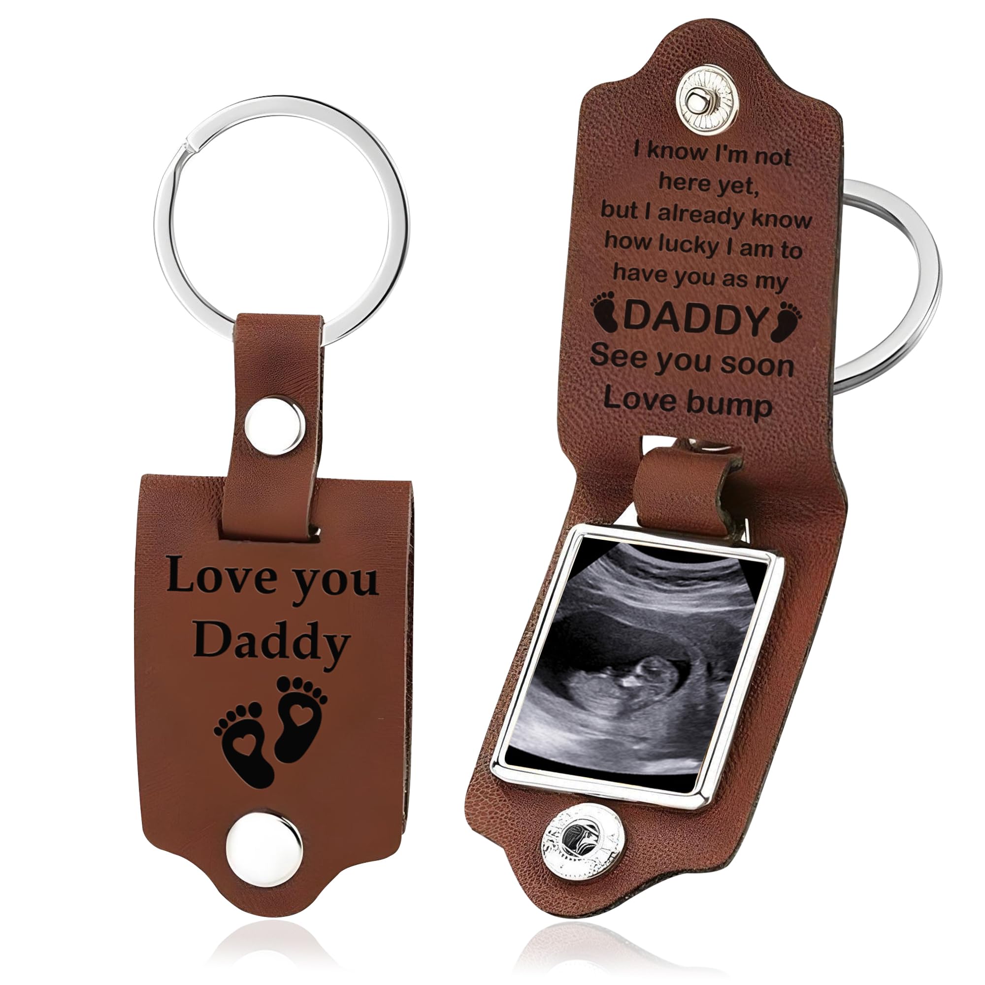 Terri Berri Store Personalized Ultrasound Leather Keychain - Custom Baby Ultrasound Photo Gift New Dad Father's Day Gift, Baby Photo Keychain Birthday