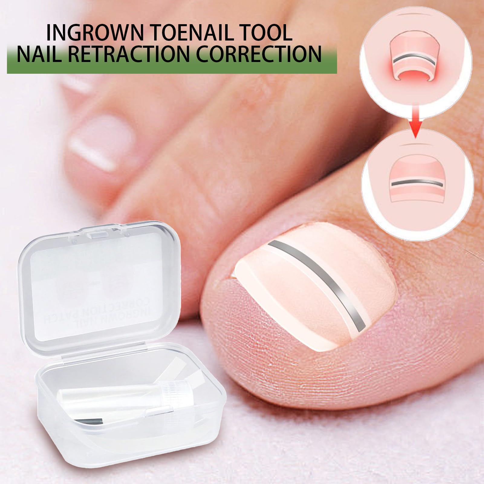 Patch Correction Ongles - 10 Patchs de Correction pour Ongles de Pied | Réparation et Soin pour les Pieds des Adultes, Hommes et Femmes, Utilisation