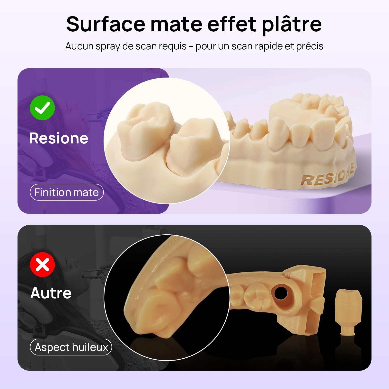 RESIONE D01S Résine de Modèle Dentaire - Resine Imprimante 3D avec Haute Précision pour Restauration Dentaire & Implant & Modèles d'Étude (Couleur coquillage-1KG)