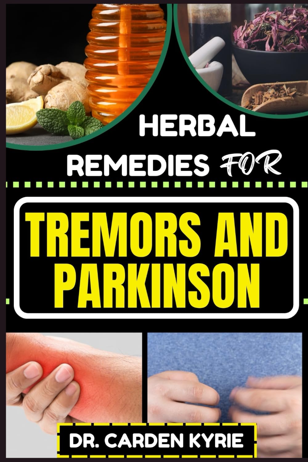 HERBAL REMEDIES FOR TREMORS AND PARKINSON: Empower Your Wellness Journey With Herbs For Targeting Symptom Relief, Holistic Health And Sustainable Lifestyle Practices