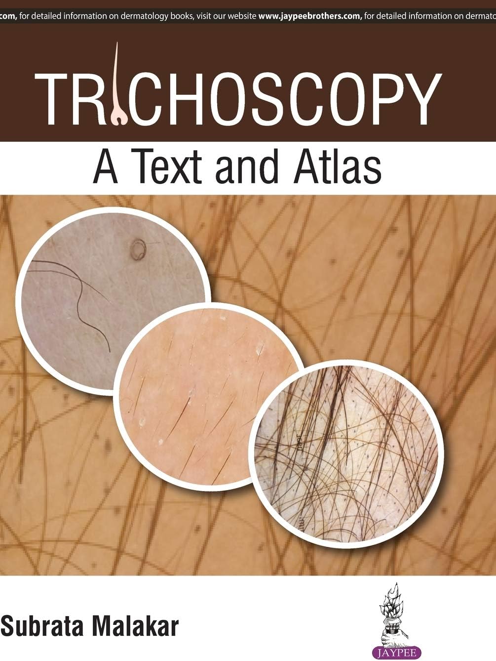 Trichoscopy: A Text and Atlas