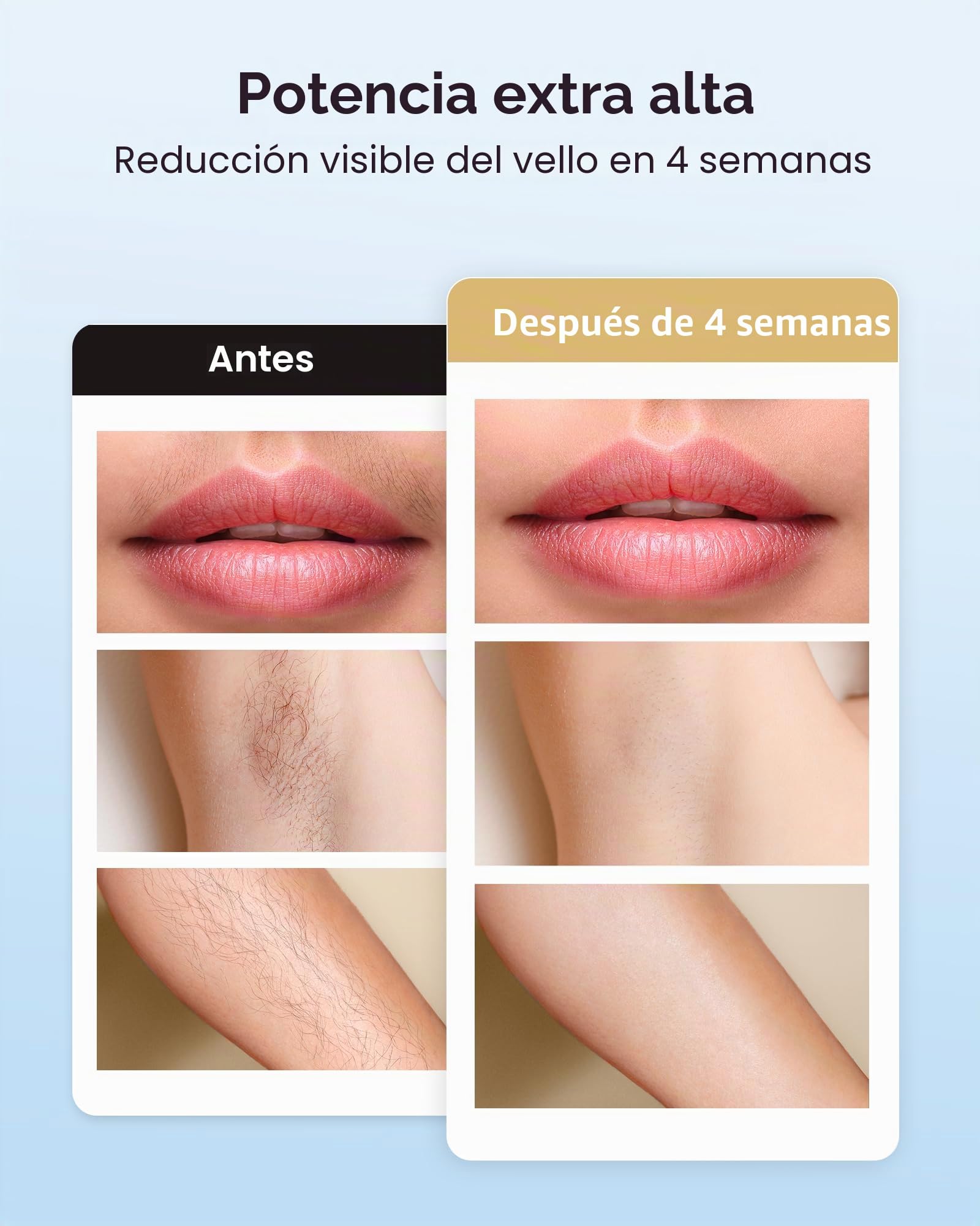 INNZA - Depiladora IPL con función de enfriamiento por hielo para mujeres, resultados duraderos, 999.999 destellos, dispositivo de depilación sin dolor para axilas, piernas, brazos y línea del bikini