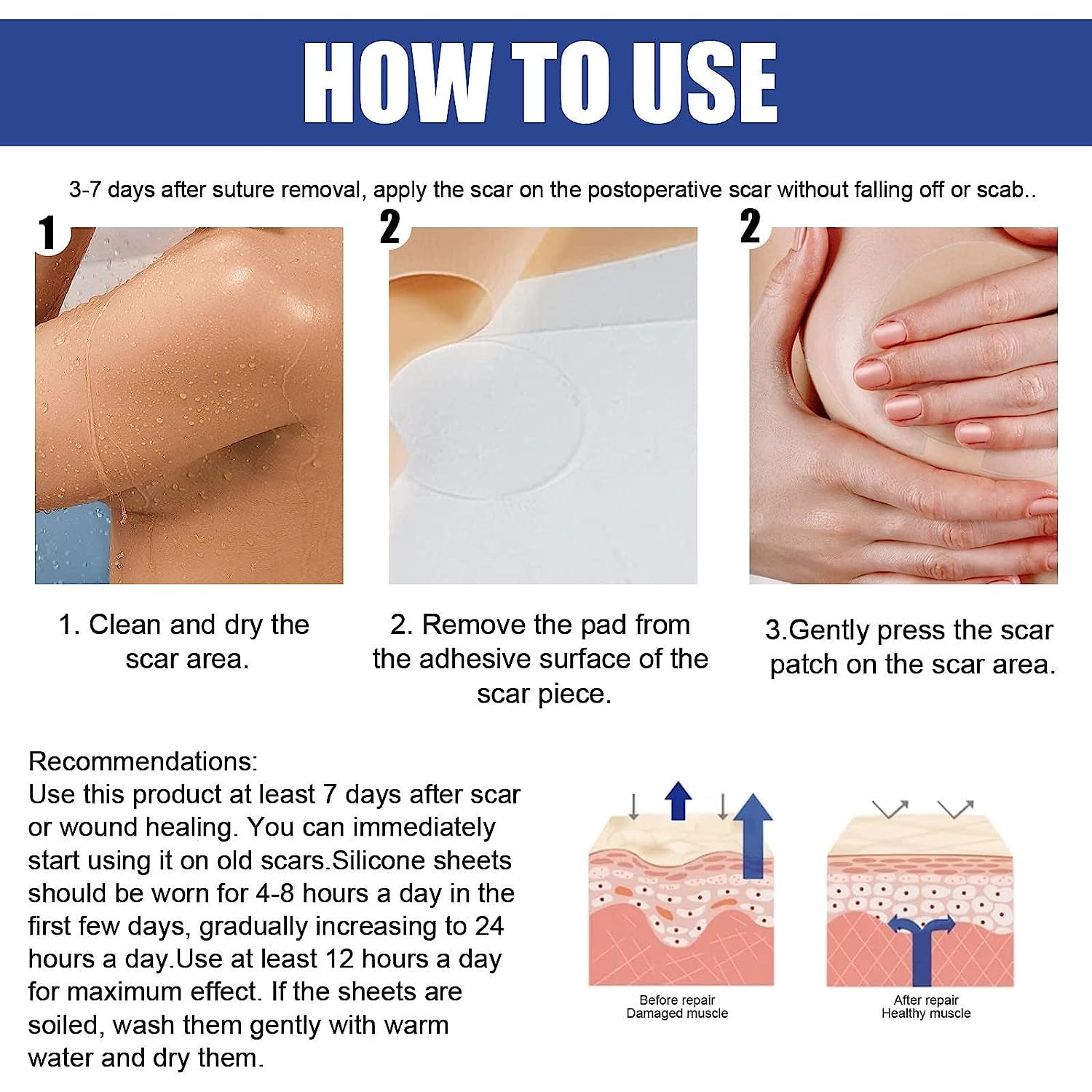 1/2/3Box Silicone Scar Sheets Silicone Scar Sheets For Breast 8 Pack Breast Reduction After For Scar Removal Sheets 4 Areola Soft Strips 4 Sheets (2Box)