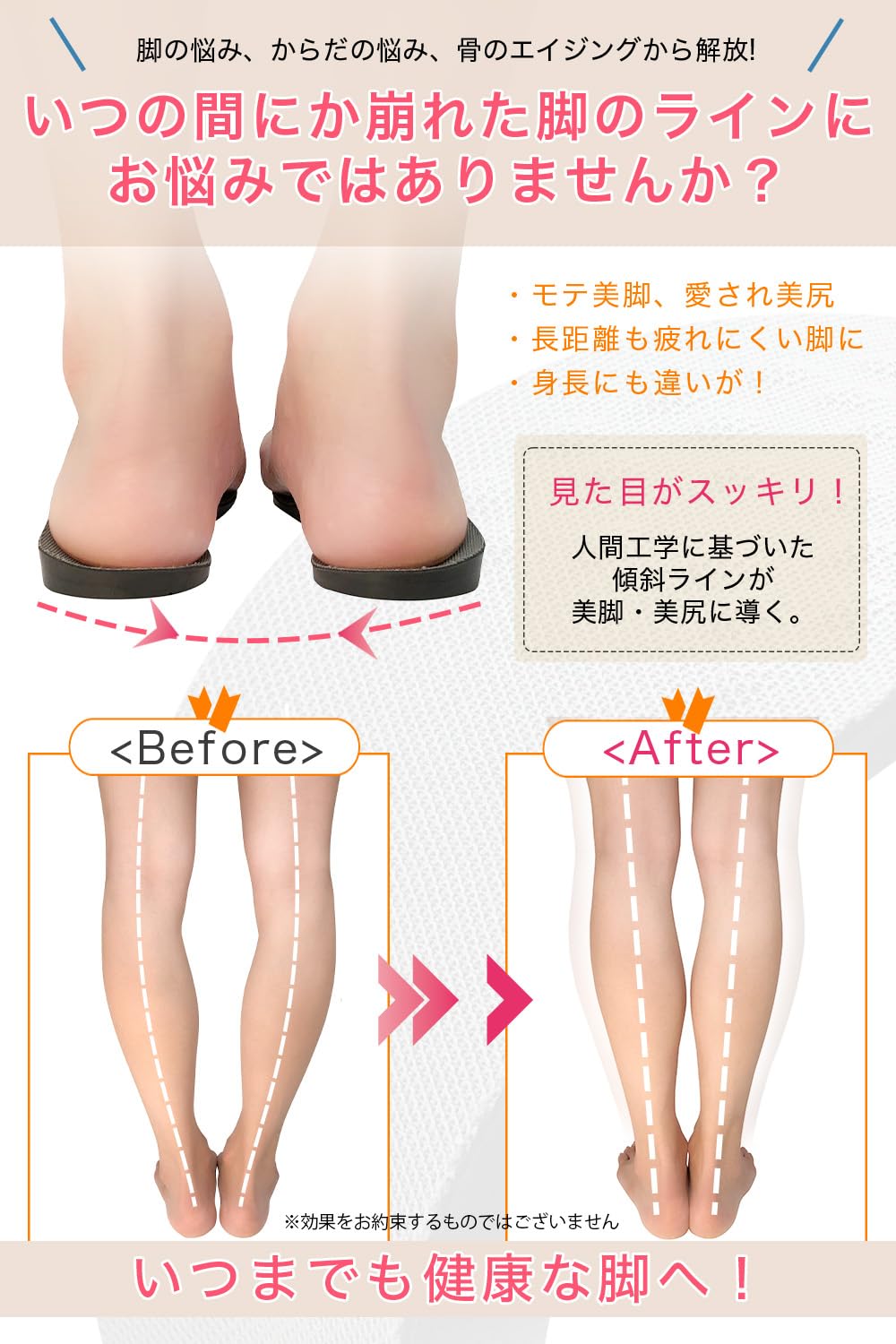 Amazon.co.jp: 【先生監修】 O型脚 傾斜 インソール 5サイズ グレー 