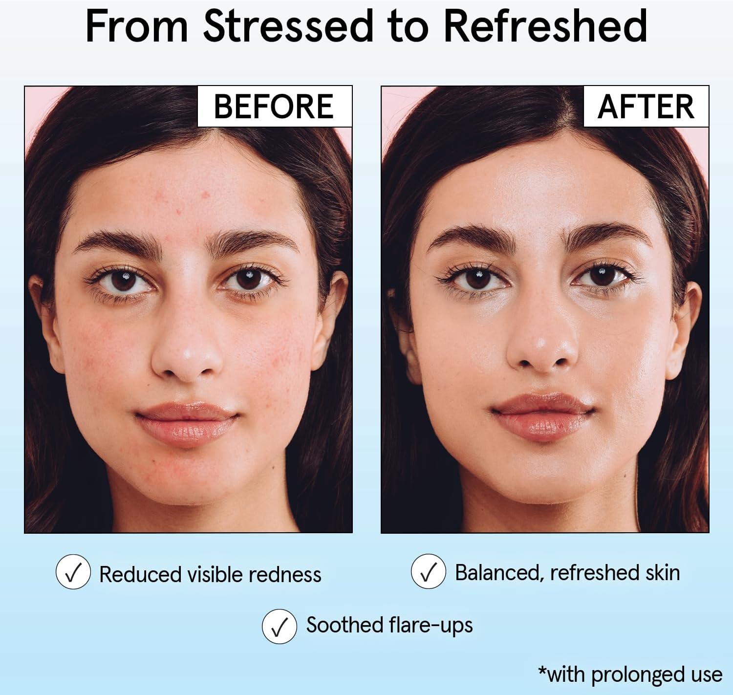 grace & stella Hypochlorous Acid Spray for Face - Acne Spray - Gentle Face Mist to Calm Redness, Flare-Ups, Breakouts, Body Acne, Bacne - Soothing Facial Mist for Sensitive Skin (120ml/4 fl oz) - Image 4