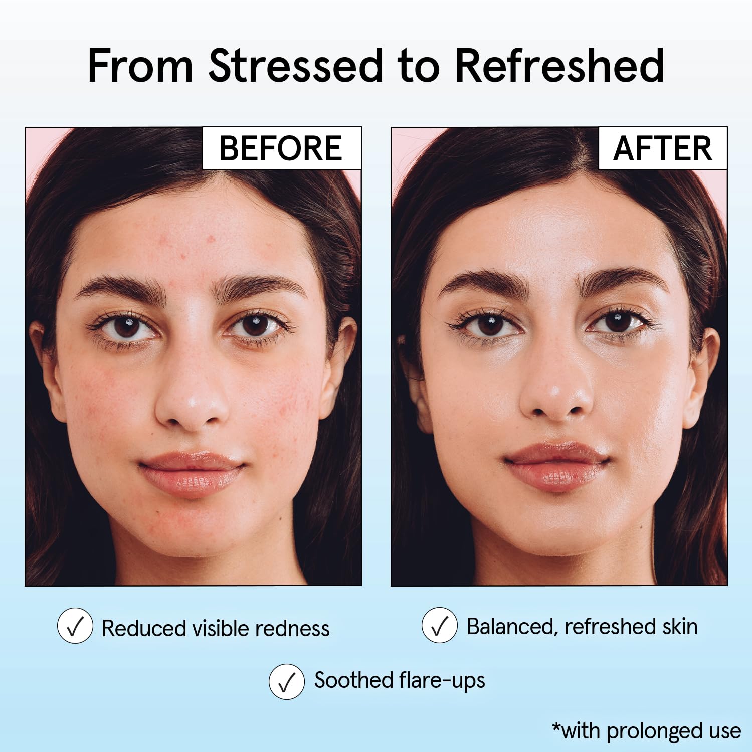 grace & stella Hypochlorous Acid Spray for Face - Acne Spray - Gentle Face Mist to Calm Redness, Flare-Ups, Breakouts, Body Acne, Bacne - Soothing Facial Mist for Sensitive Skin (120ml/4 fl oz)