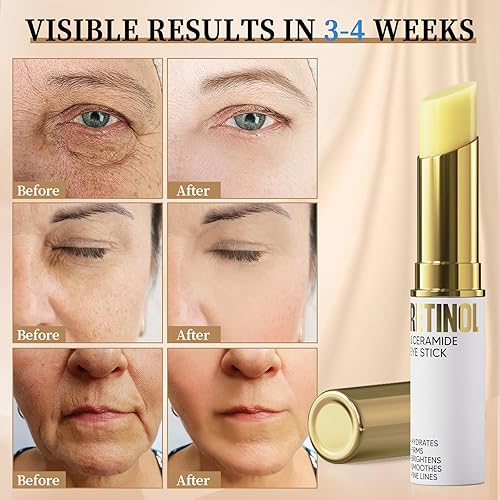 Miniatura 4 de Lápiz de ojos con retinol, crema de ojos para ojeras e hinchazón, bálsamo de ojos hidratante e iluminador, crema para debajo de los ojos