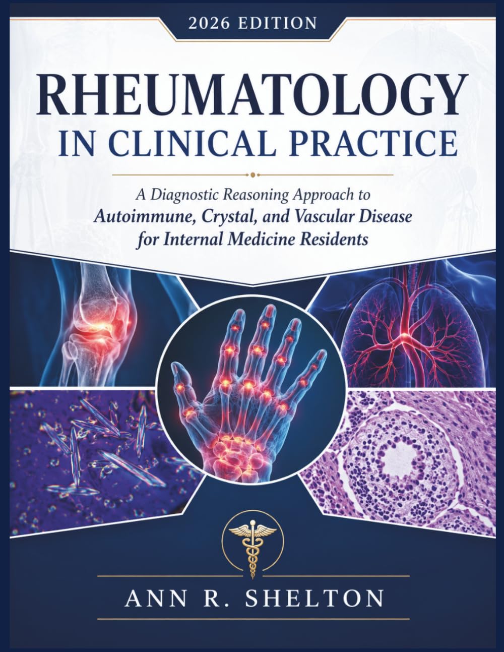 Rheumatology in Clinical Practice: A Diagnostic Reasoning Approach to Autoimmune, Crystal, and Vascular Disease for Internal Medicine Residents