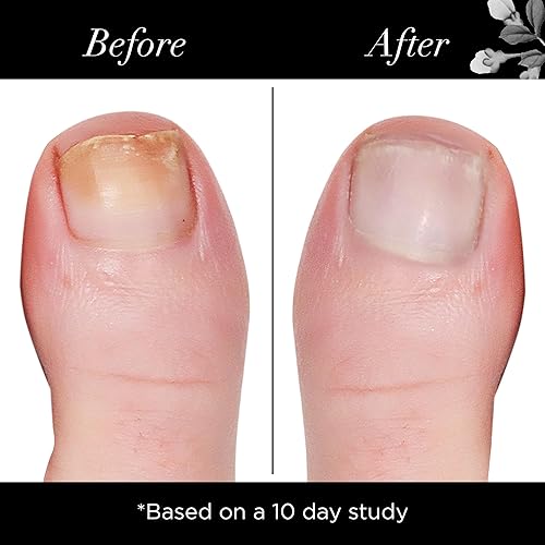 Miniatura 4 de butter LONDON Fortalecedor de uñas para uñas dañadas, suaviza el amarillo - Endurecedor de uñas y esmalte fortalecedor exfolia, ilumina y rejuvenece