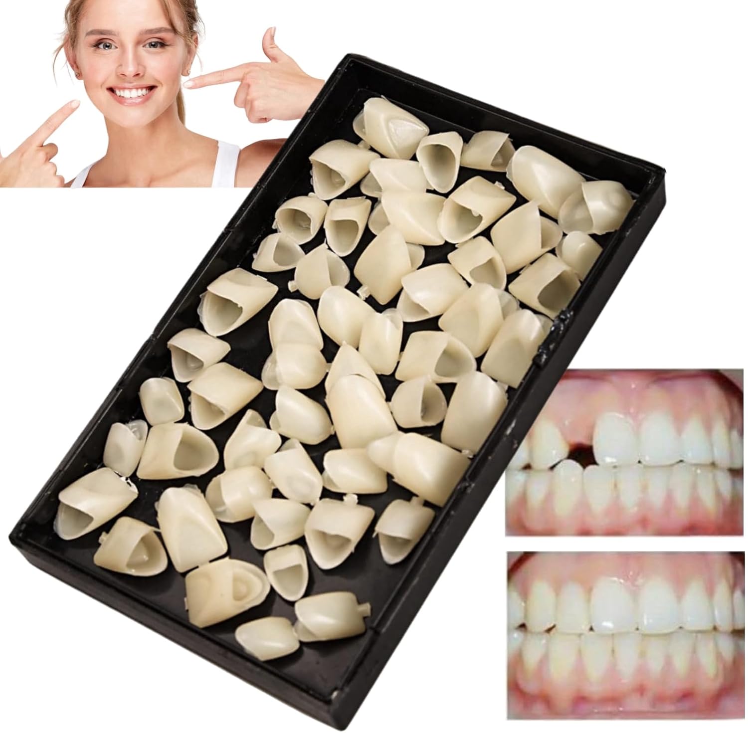 70PCS Temporary Tooth Crown,Temporary Crowns for Teeth,Tooth Repair Kit