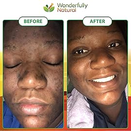 Wonderfully Natural 1 African Black Soap for Acne & Dark Spots | Organic Vegan Satisfaction Guarantee | 1lb bar 90 day Supply