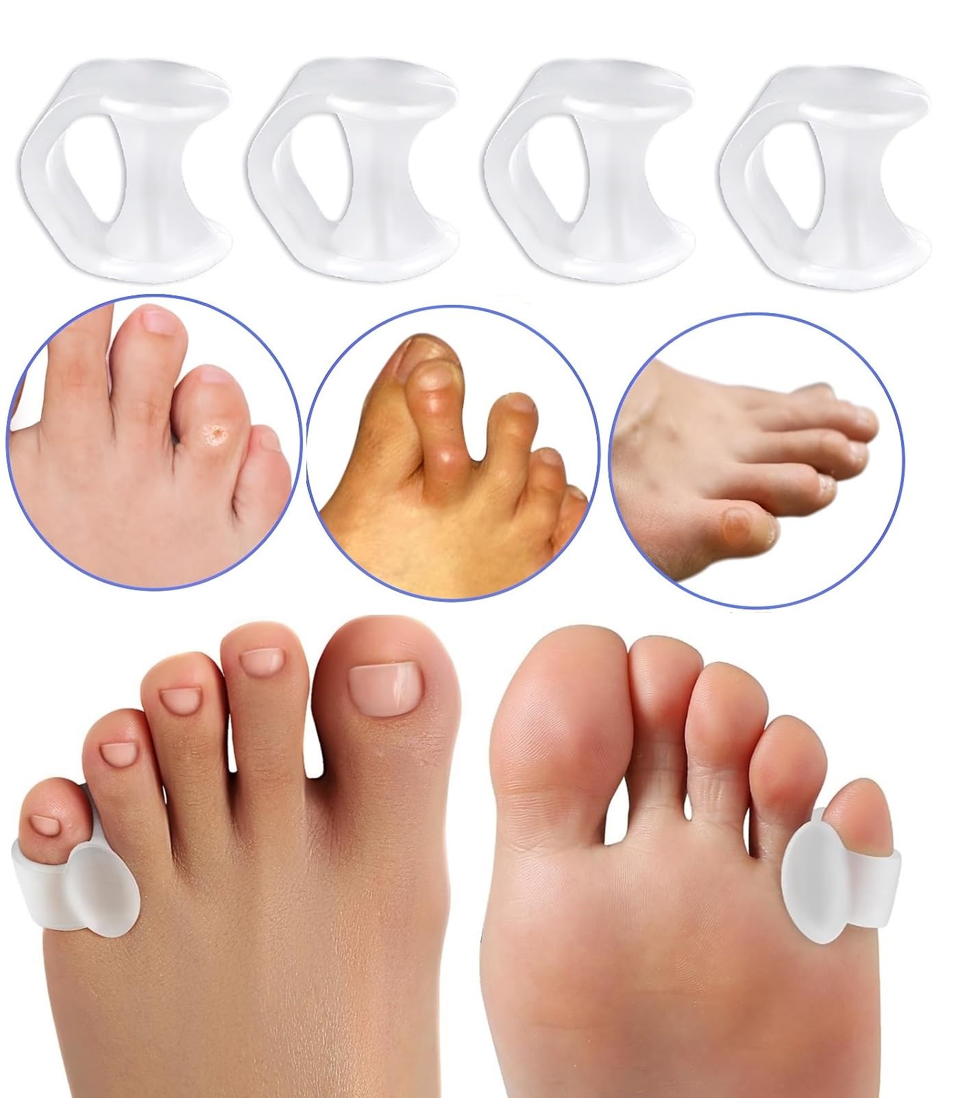 Separadores de dedos de gel Pinky Toe, 4 separadores de silicona para alivio de presión y dolor