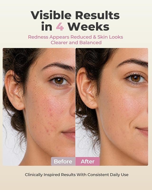 Red Light Therapy Mask for Face, Fine Lines, Acne & Radiance image 4