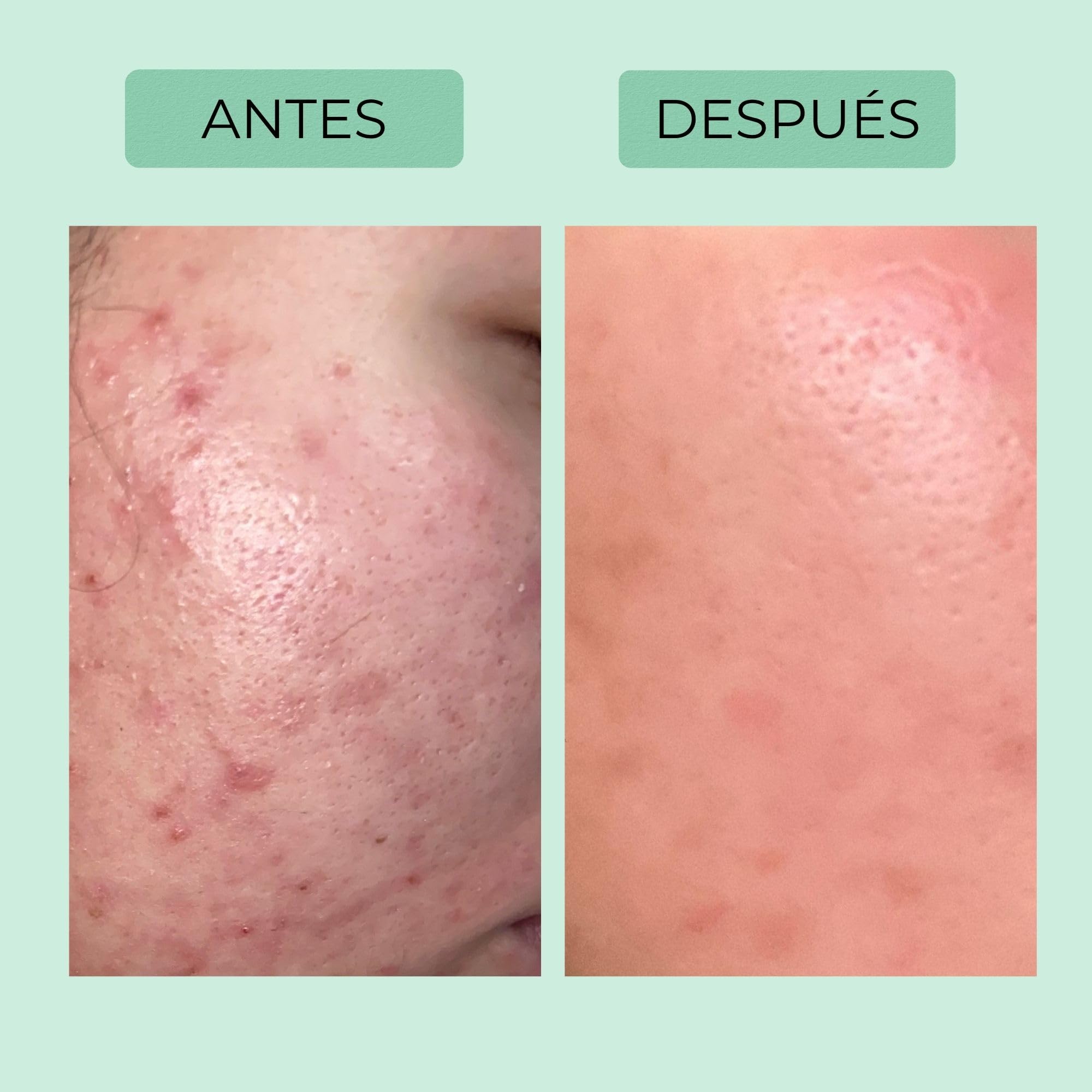 Afrodita Professional Niacinamida Gel limpiador para pieles grasas y mixtas, limpiador facial suave con ácido hialurónico, limpieza profunda de poros, 94% de origen natural, sin alcohol ni sulfatos