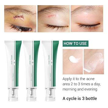 Scar Cream, Face Pimples Scar Stretch Marks Cream Moisturizing Repair Damaged Skin Gel Scar Treatment
