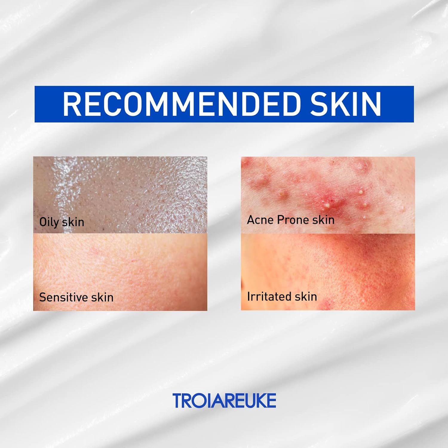 TROIAREUKE ACSEN Recovery Cream | Hydrating, Soothing, Facial Moisturizer, Centella Asiatica, Olive Oil, Squalane, Sensitive, Dry, Dehydrated Skin, Reduces Signs of Acne Scars