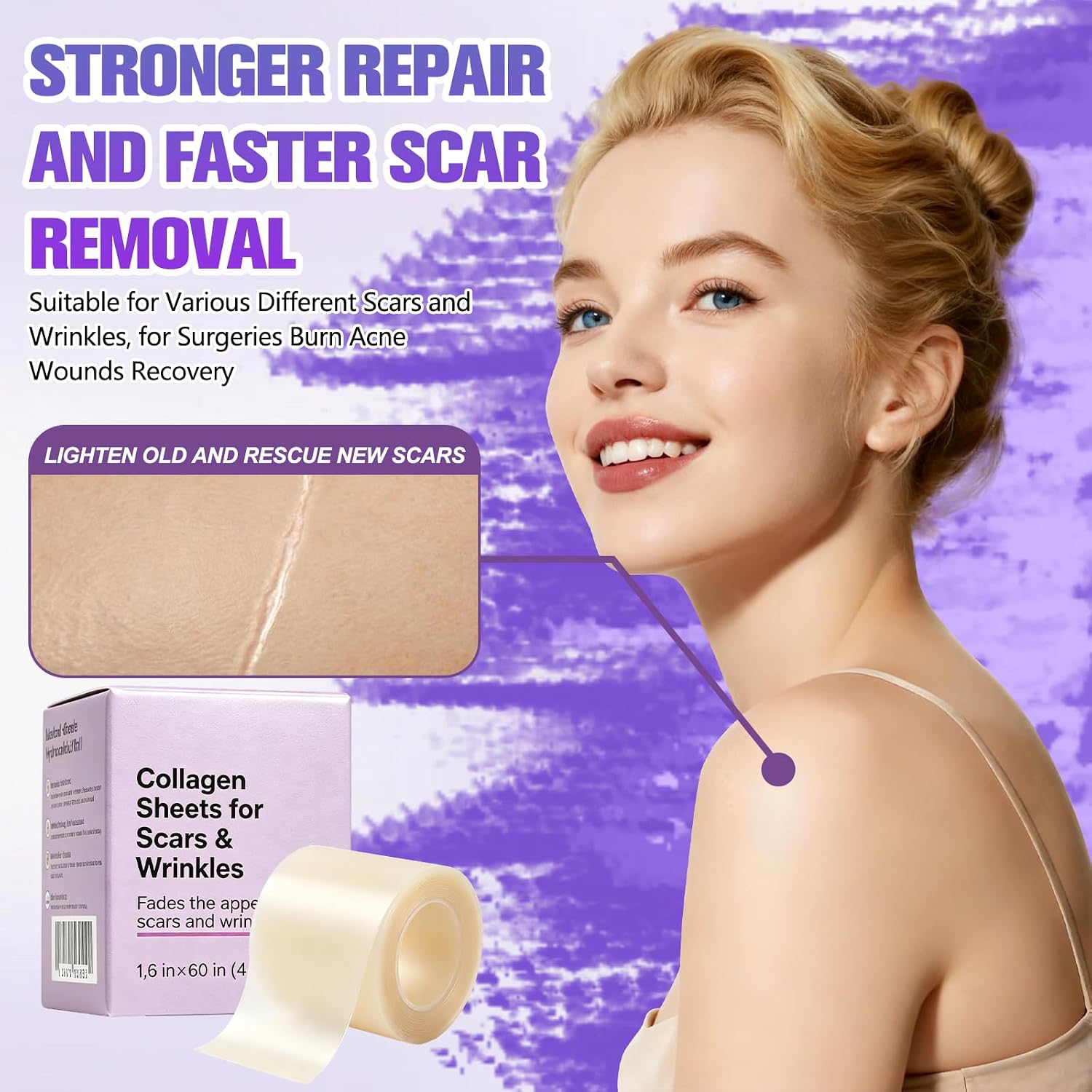 Silicone Collagen Scar Tape, Collagen Sheets for Scars & Wrinkle, Silicone Scar Removal Strips for Various Different Scars and Wrinkles, Old & New Scars for All Ages (1.6In * 60In)