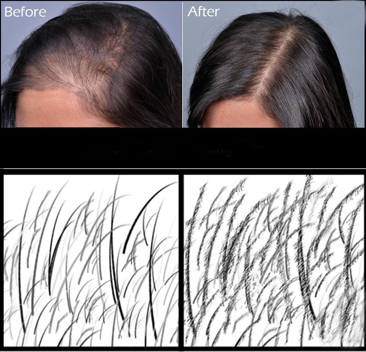 XL HAIR FIBERS~50g oder 100g PREMIUM-DELUXE~XL REFILL SCHÜTTHAAR NACHFÜLLBEUTEL ver. Farben SCHÜTTHAARE~MICROHAARFASER~ ~STEUHAAR~BEI HAARAUSFALL (Dunkelbraun - Dark Brown XXL 100g)