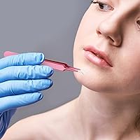 Vista 5 de Honoson 3 pinzas de espinillas de acero inoxidable, herramienta extractor para quitar puntos negros, espinillas, espinillas, curvas, herramientas