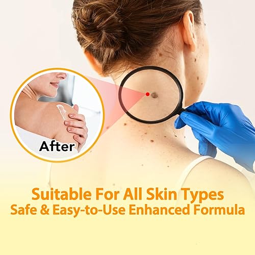 Miniatura 3 de Bee Venom Cream, crema hidratante hidratante para todas las partes del cuerpo 100 g  3.52 oz