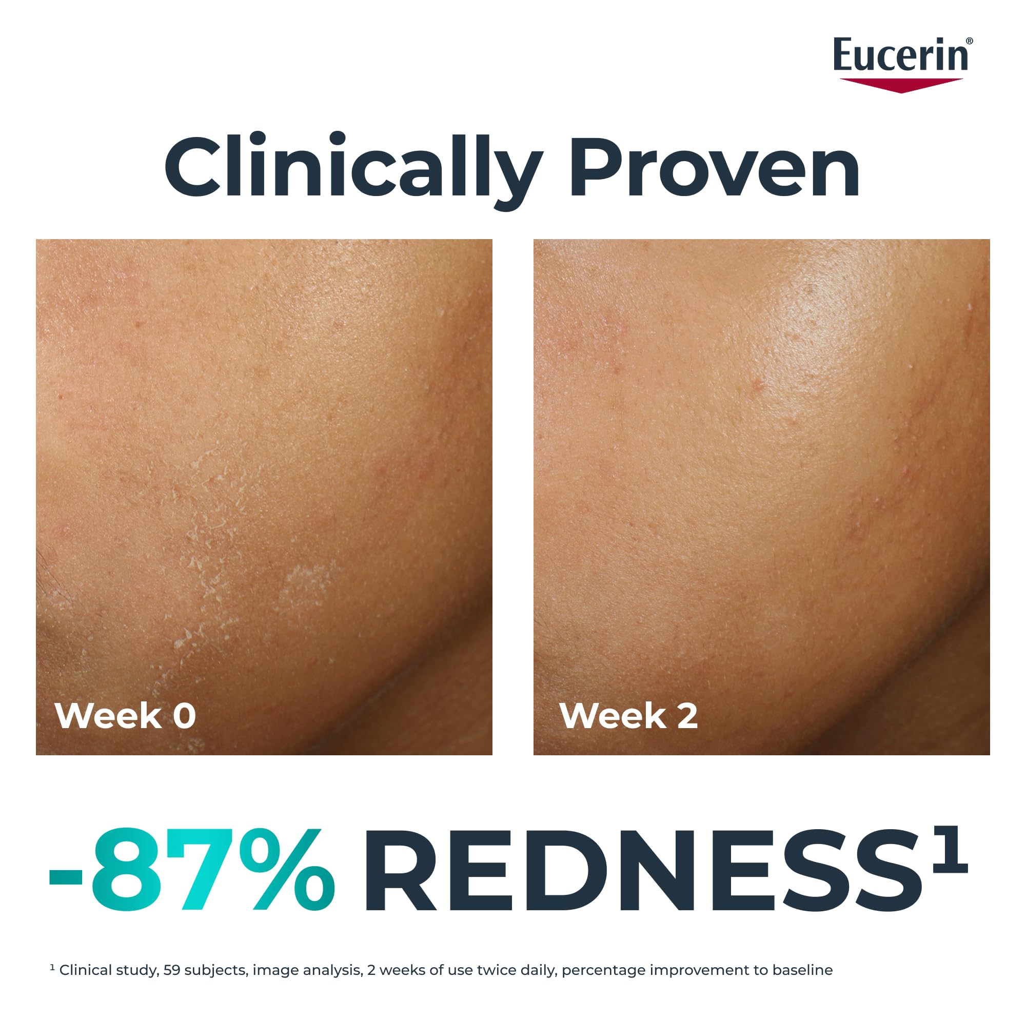 Eucerin Dermopure Clinical Hydra Repair Fluid 40ml - Image 3