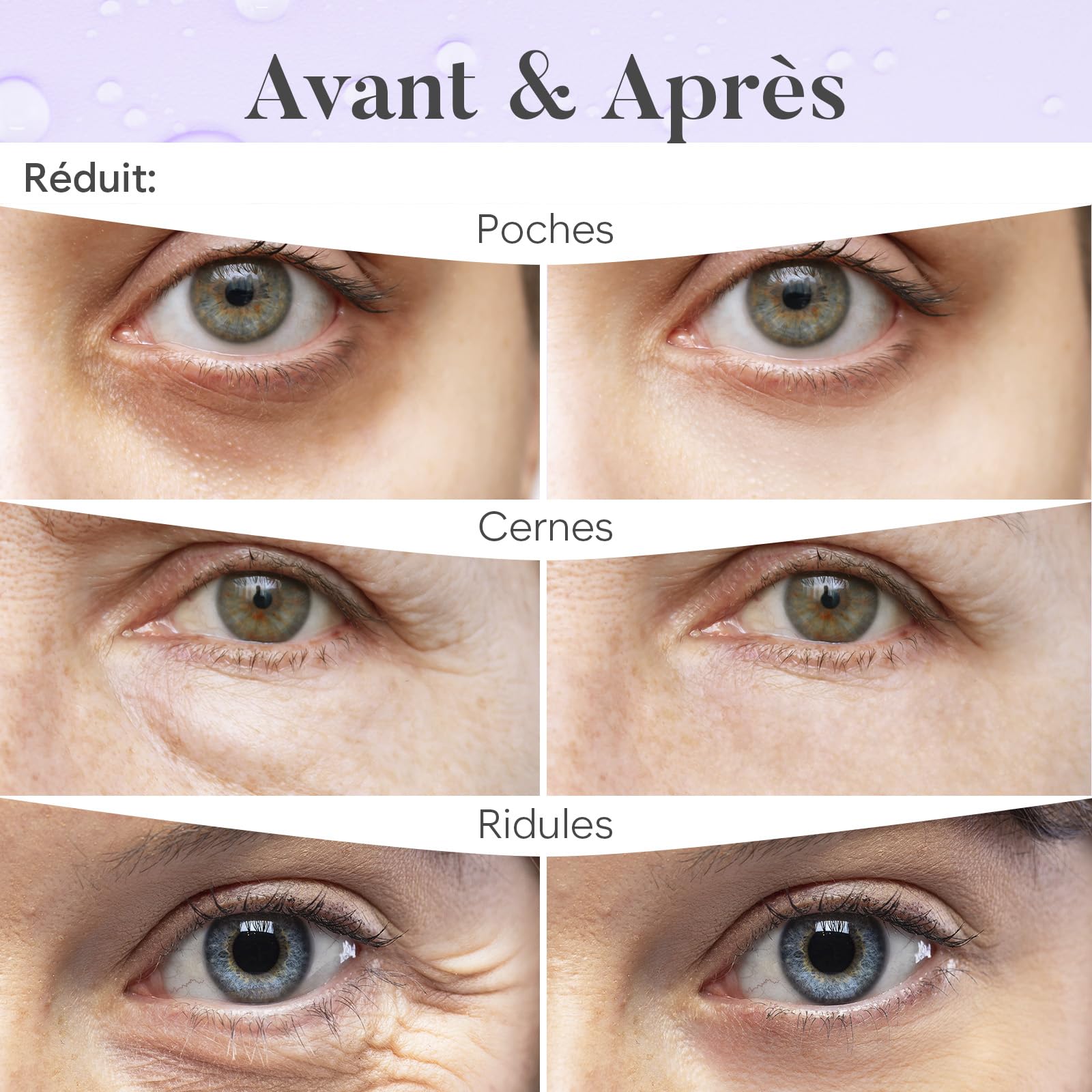 Patch Yeux Anti Cernes (30 paires, Jour et Nuit), Masque Yeux avec Caféine, Collagène et Acide Hyaluronique, Patch Anti Cernes, Eye Mask pour l'hydratation et les poches